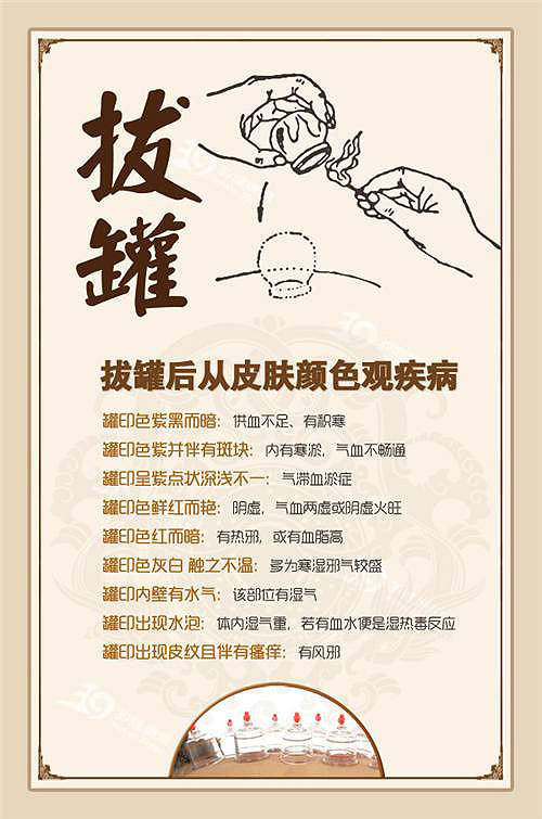 【IM电竞平台】关节疼痛分不清到底是风湿还是类风湿,专家来告诉你!(图2) IM电竞